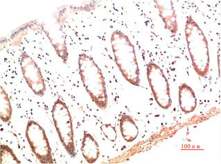 Anti-COL1A1 Monoclonal