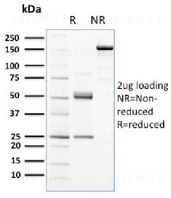 Anti-CD117 / c-Kit (Marker for Gastrointestinal Stromal Tumors) Monoclonal Antibody (Clone: KIT/2672