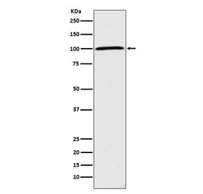 Anti-Sodium Potassium ATPase / ATP1A1, clone AID-1