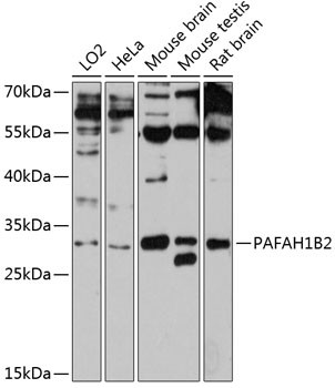 Anti-PAFAH1B2