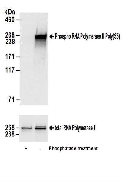 Anti-RNA Polymerase II, Phospho (S5)