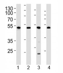 Anti-Cdk9