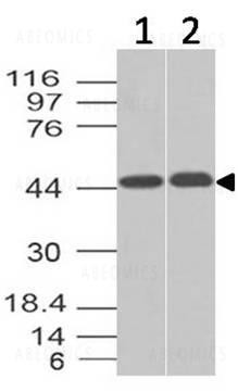 Anti-Napsin A (Clone: ABM4H60)