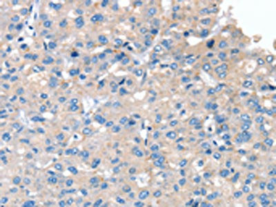 Anti-SERPINB2
