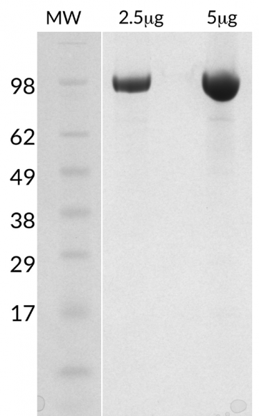 Ubiquitin Activating Enzyme E1 [UBA1] (human) (rec.) (His)