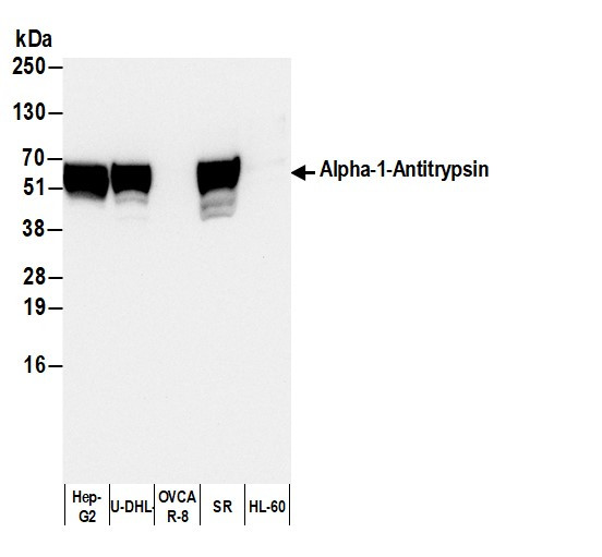 Anti-Human Alpha-1-Antitrypsin, HRP conjugated