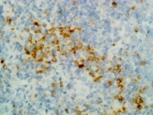 Anti-Gamma Heavy Chain (human), Rabbit Monoclonal (RM116)
