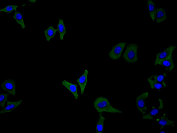 Anti-CSF2RB, recombinant clone 9C9