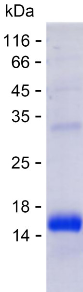 Recombinant Human PIGX Protein