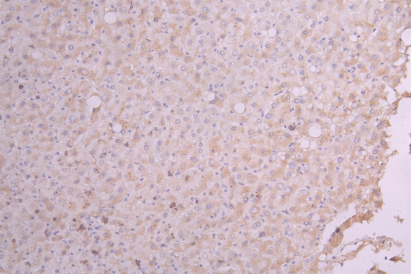 Anti-IGF1, recombinant clone 2F2