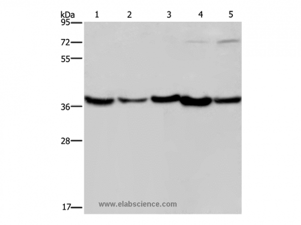 Anti-DNAJB4