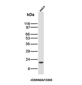 Anti-p16INK4a / CDKN2A, clone rCDKN2A/13303