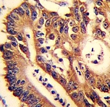 Anti-Cytokeratin 12