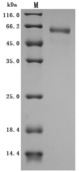 Cytokine receptor common subunit beta (CSF2RB), partial (Active), human, recombinant