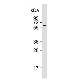 Anti-ACVR1 / ALK2