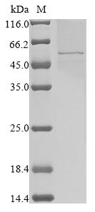 Nucleoprotein (N), human coronavirus 229E, recombinant