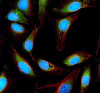 Anti-ESD / Esterase D
