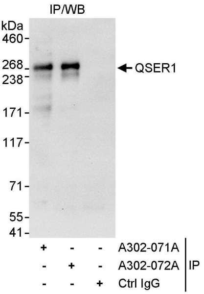 Anti-QSER1