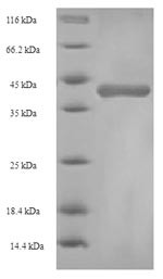 Glutathione S-transferase alpha-1 (Gsta1), rat, recombinant
