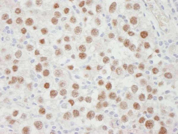 Anti-MCM5 (IHC)
