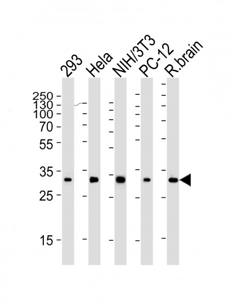 Anti-S6 Ribosomal Protein, clone 981CT2.1.1
