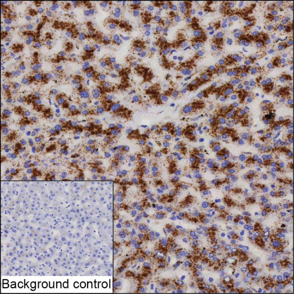 Anti-Lysosome Membrane Protein 2