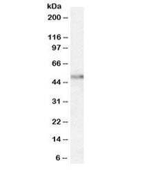 Anti-Orexin Receptor 2