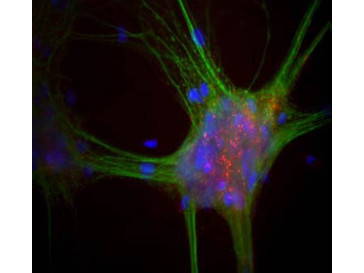 Anti-alpha Synuclein, clone 3H9