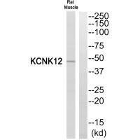 Anti-KCNK12