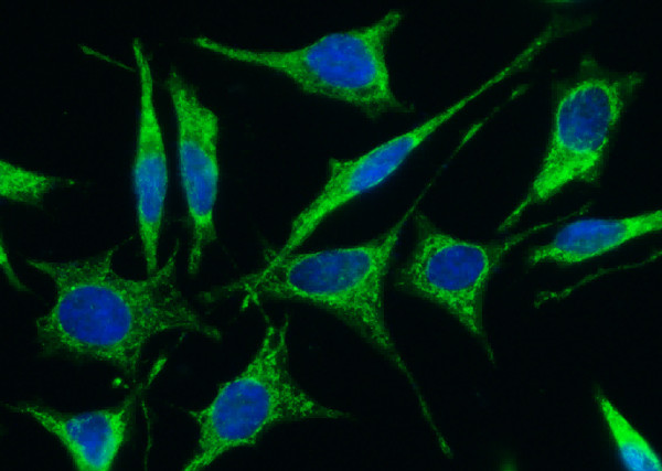 Anti-FSTL1 Monoclonal Recombinant Antibody