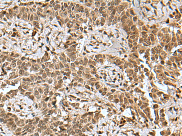 Anti-BCL7B