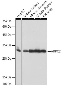 Anti-ARPC2