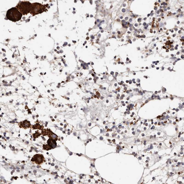 Anti-PTPN22