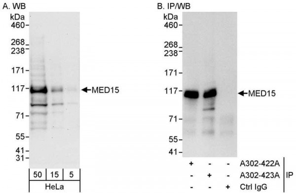 Anti-MED15