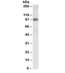 Anti-ABCC4