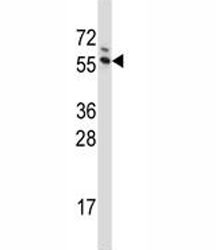Anti-G3BP1