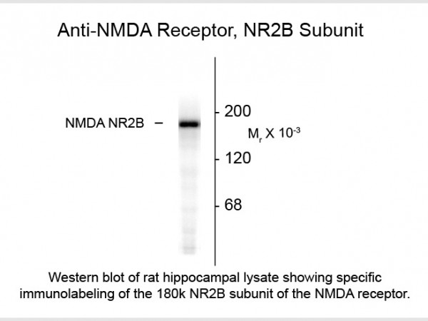 Anti-NMDA R2B