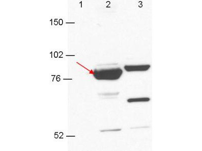 Anti-ESRP-1/2 (Epithelial Splicing Regulatory Protein 1/2)