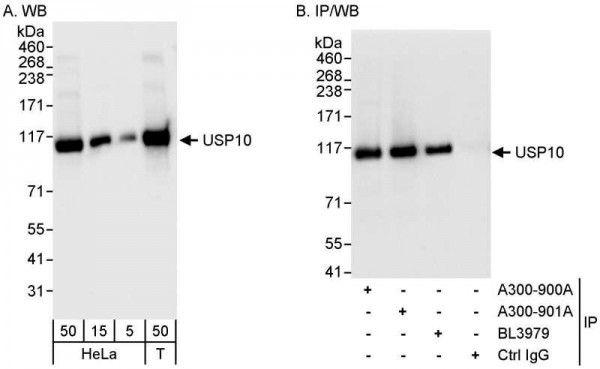 Anti-USP10