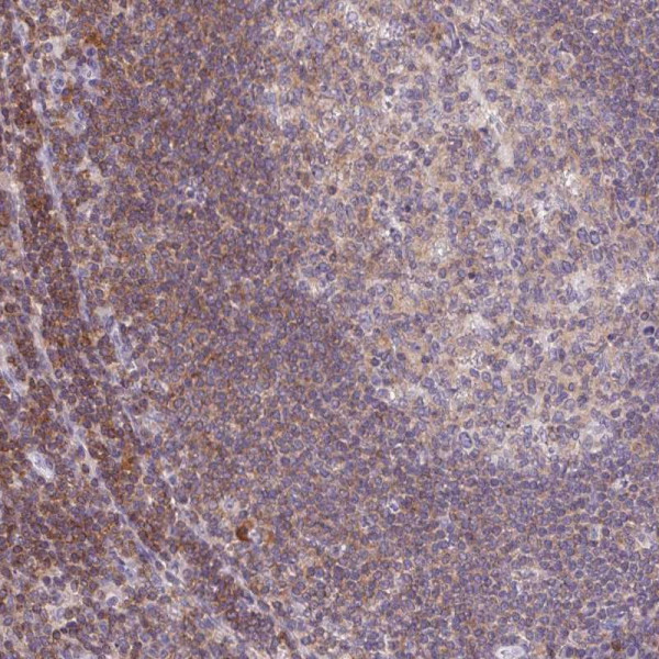 Anti-KIF26A