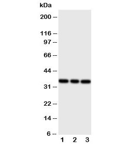 Anti-BSP Bone Sialoprotein