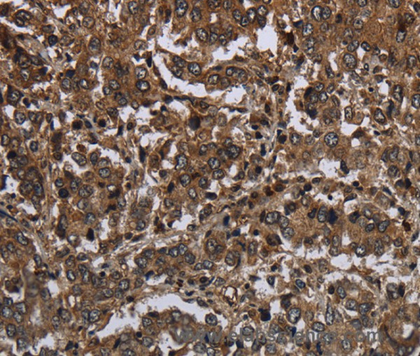 Anti-GLIPR1