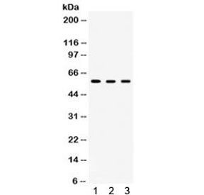 Anti-TCP1 delta / CCT4