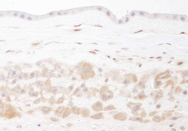 Anti-PBEF (IHC)