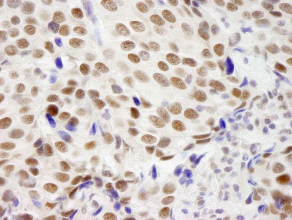 Anti-ZNF261 (IHC)