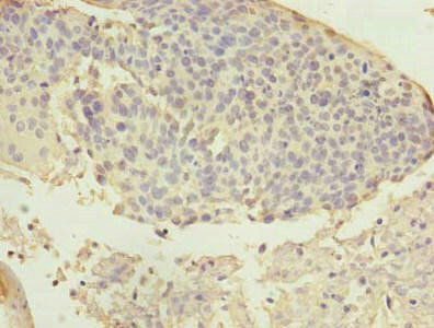 Anti-ARMC7