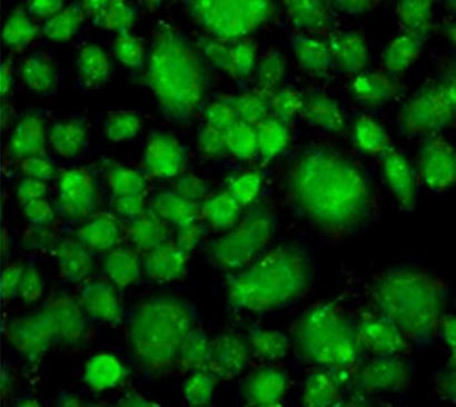 Anti-TP53BP2 / ASPP2