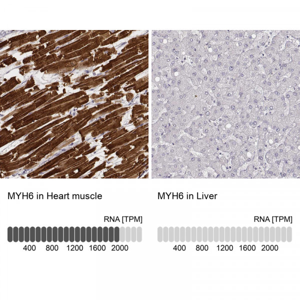 Anti-MYH6, clone CL2162