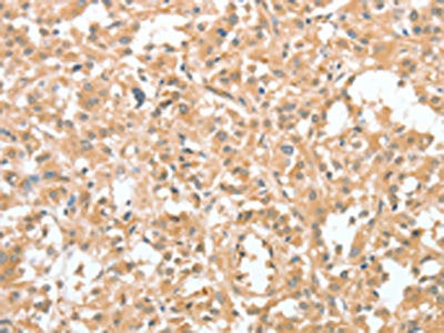 Anti-CIAPIN1