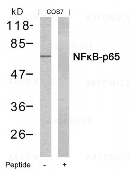 Anti-NFkB -p65 (Ab-435)